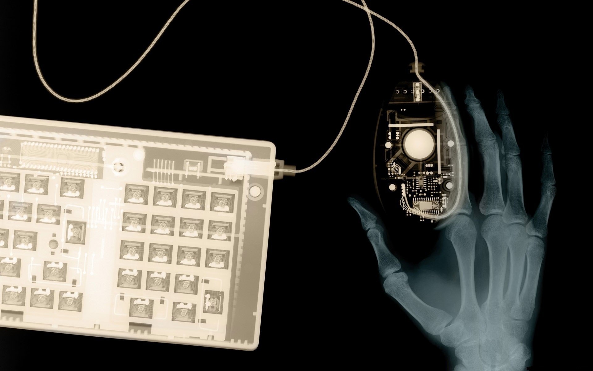 Рентген человеческой руки с мышкой и клавиатурой